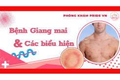 Bệnh Giang Mai Là Gì? Triệu Chứng Từng Giai Đoạn & Điều Trị Tại Pride VN