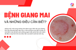 BỆNH GIANG MAI VÀ NHỮNG ĐIỀU CẦN BIẾT?